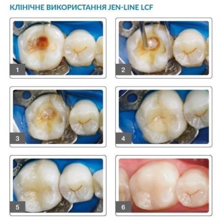 imgi_24_jen-line-lcf=1-700×700