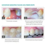 Jen-Fiber Rope (Джен-Файбер Роуп), Пак.: 3 х шнур 9см діам.= 1.50 мм - Шинуючий шнур (скловолокно) (Джендентал-Україна)