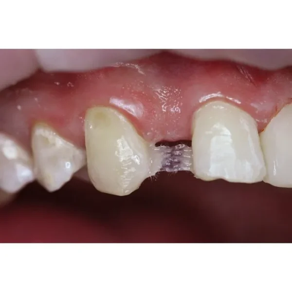 Jen-Fiber Rope (Джен-Файбер Роуп), Пак.: 3 х шнур 9см діам.= 1.50 мм - Шинуючий шнур (скловолокно) (Джендентал-Україна)