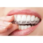 Zuremin-CaPF (Зуремін), Н-р: 2х5мл - Ремінералізуючий гель (Джендентал-Україна)