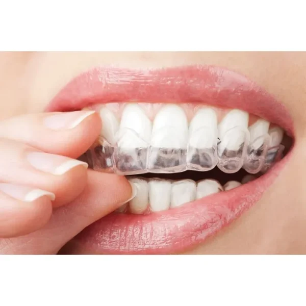 Zuremin-CaPF (Зуремін), Н-р: 2х5мл - Ремінералізуючий гель (Джендентал-Україна)